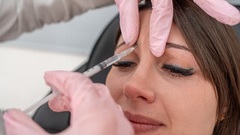 Frown Lines Treatement with Botox