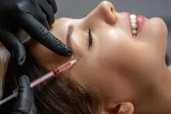 Temple Filler Treatment